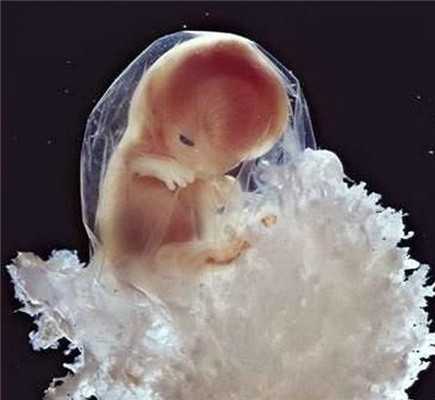 顺德首例卵子冷冻技术宝宝出生，夫妻申请手术