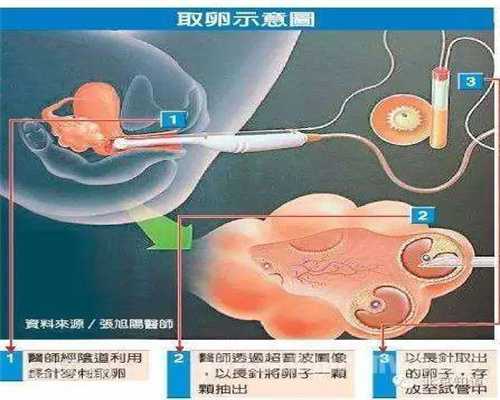 精子与卵子顺利结合的过程60：代孕妈妈 费用