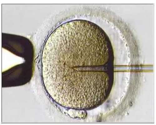 精子与卵子结合要多长时间85：代孕夫txt新浪