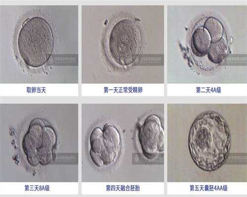 贵阳捐卵试管，中国试管婴儿 PK 美国试管婴儿，
