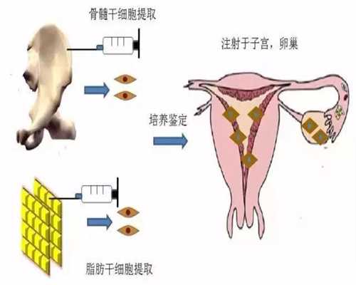 广东捐卵流程是怎样的？单卵双胞胎和双卵双胞