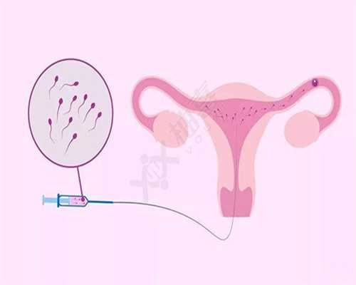 珠海中国女性捐卵_如何预防卵巢囊肿！