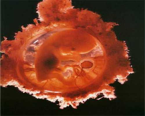 东莞代妈捐卵~供卵助孕网卵巢早衰供卵后胚停吗卵巢早衰的人供卵有身会潮热