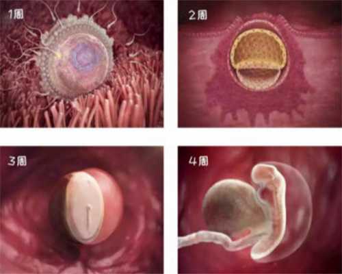 日本赴美捐卵~试管婴儿 囊胚移植过程！以及卵泡发育不良的原因！_1