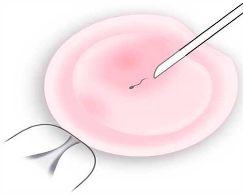 济宁正规捐卵公司,美亚麟喜科普：卵巢早衰做试管婴儿步骤有这8个_1